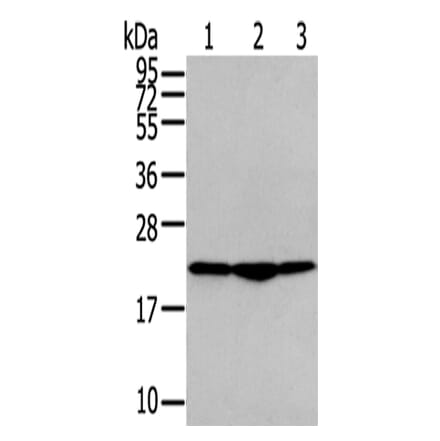 TMED2 Antibody from Signalway Antibody (43338) - Antibodies.com