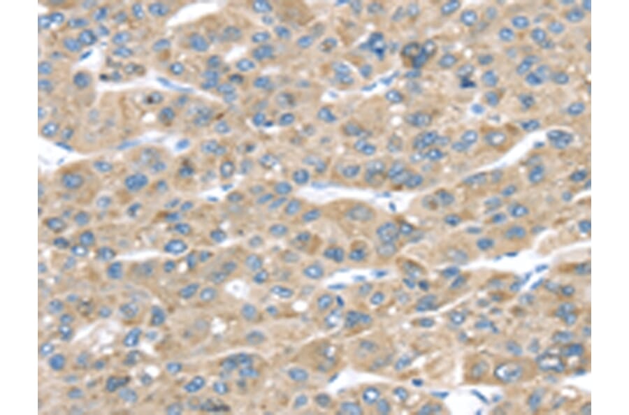 Immunohistochemistry - TMED2 Antibody from Signalway Antibody (43338) - Antibodies.com