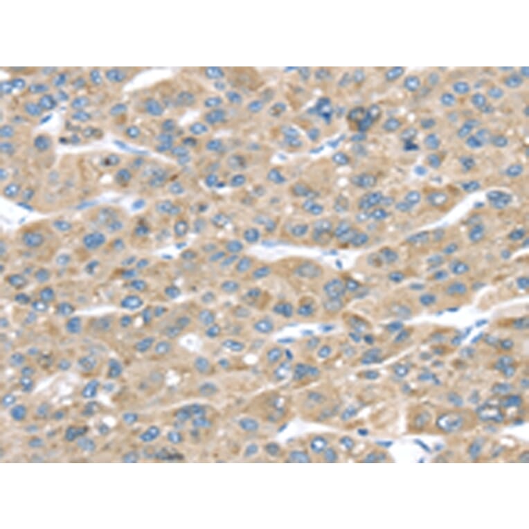 Immunohistochemistry - TMED2 Antibody from Signalway Antibody (43338) - Antibodies.com