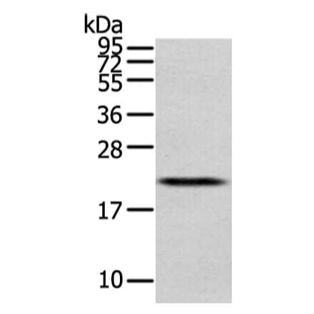 MED28 Antibody from Signalway Antibody (43339) - Antibodies.com