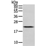 MED28 Antibody from Signalway Antibody (43339) - Antibodies.com