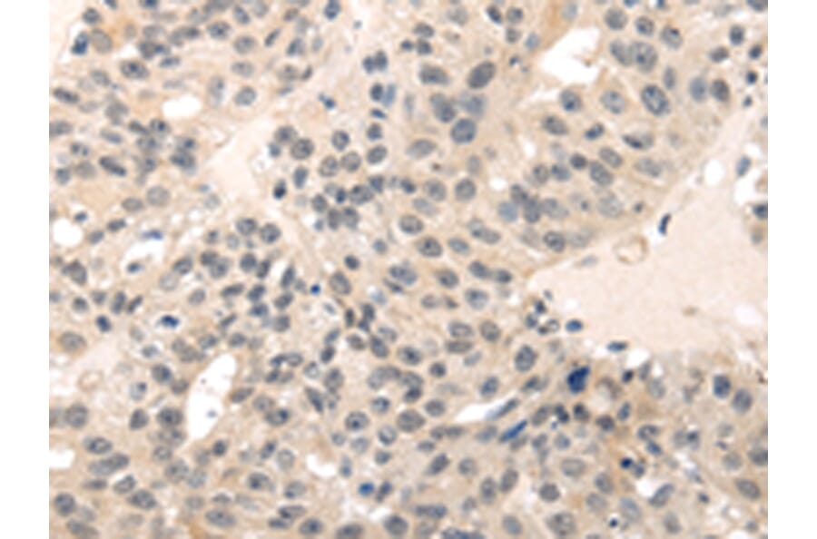 Immunohistochemistry - MED28 Antibody from Signalway Antibody (43339) - Antibodies.com