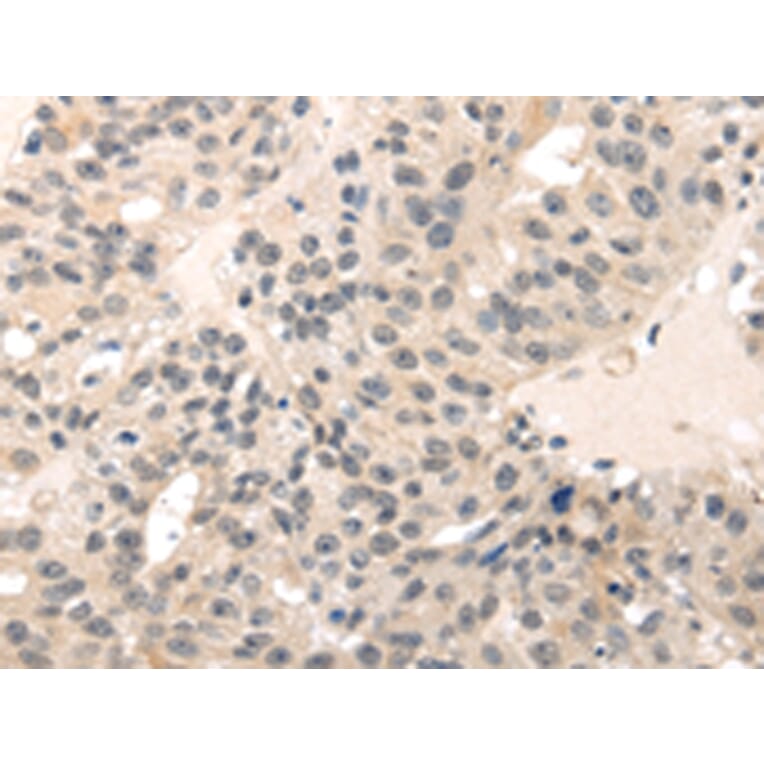 Immunohistochemistry - MED28 Antibody from Signalway Antibody (43339) - Antibodies.com