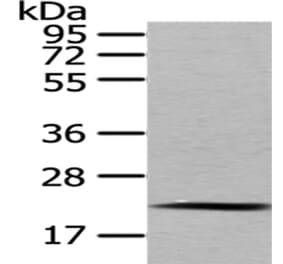 MED18 Antibody from Signalway Antibody (43341) - Antibodies.com