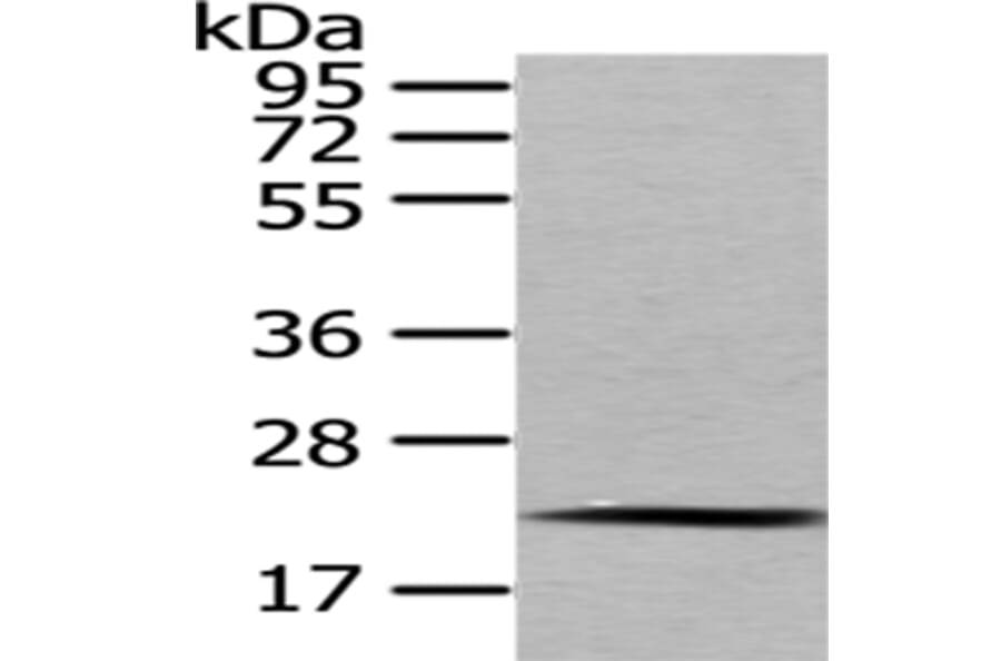 MED18 Antibody from Signalway Antibody (43341) - Antibodies.com