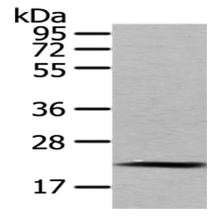 MED18 Antibody from Signalway Antibody (43341) - Antibodies.com