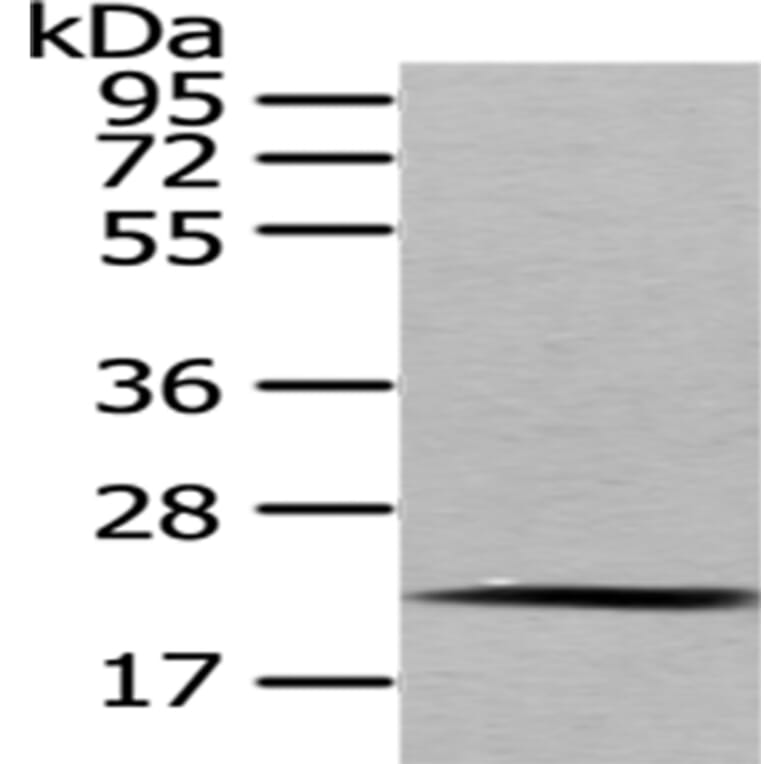 MED18 Antibody from Signalway Antibody (43341) - Antibodies.com