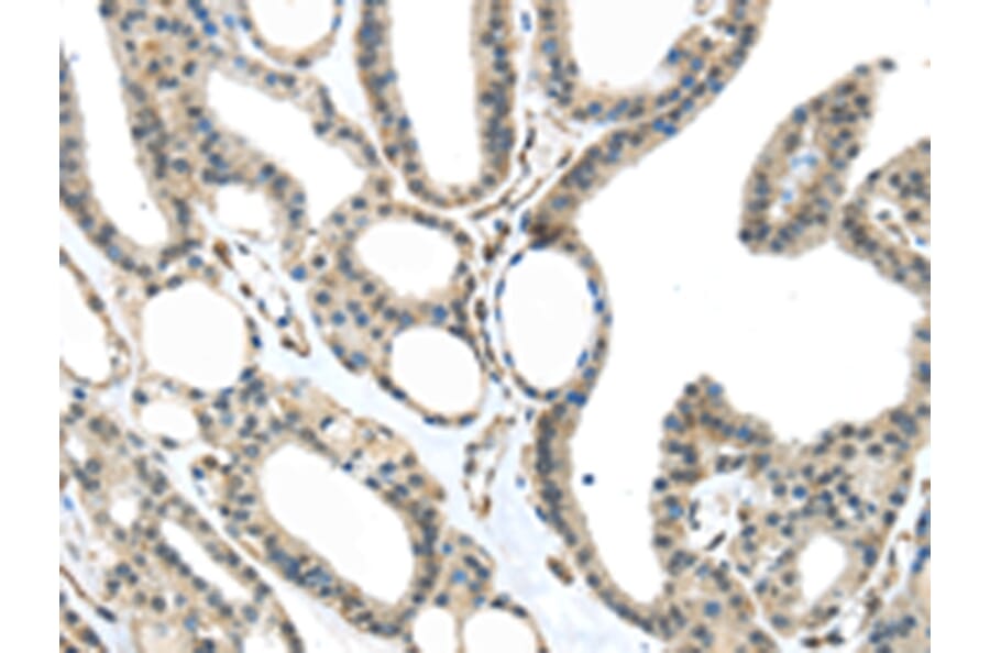 Immunohistochemistry - MED18 Antibody from Signalway Antibody (43341) - Antibodies.com