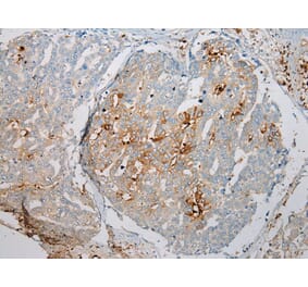 Immunohistochemistry - TREM1 Antibody from Signalway Antibody (43342) - Antibodies.com