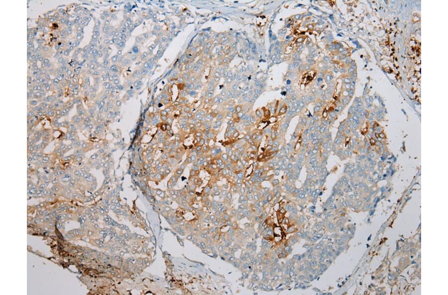 Immunohistochemistry - TREM1 Antibody from Signalway Antibody (43342) - Antibodies.com