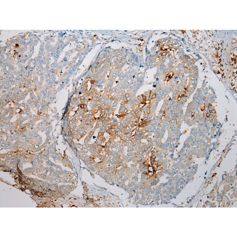 Immunohistochemistry - TREM1 Antibody from Signalway Antibody (43342) - Antibodies.com