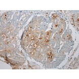 Immunohistochemistry - TREM1 Antibody from Signalway Antibody (43342) - Antibodies.com