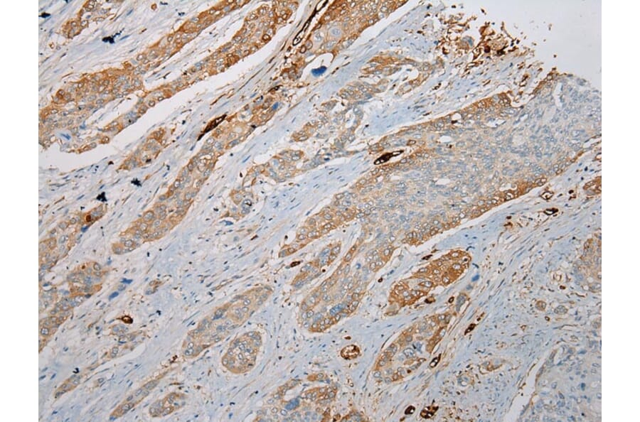 Immunohistochemistry - TREM1 Antibody from Signalway Antibody (43342) - Antibodies.com