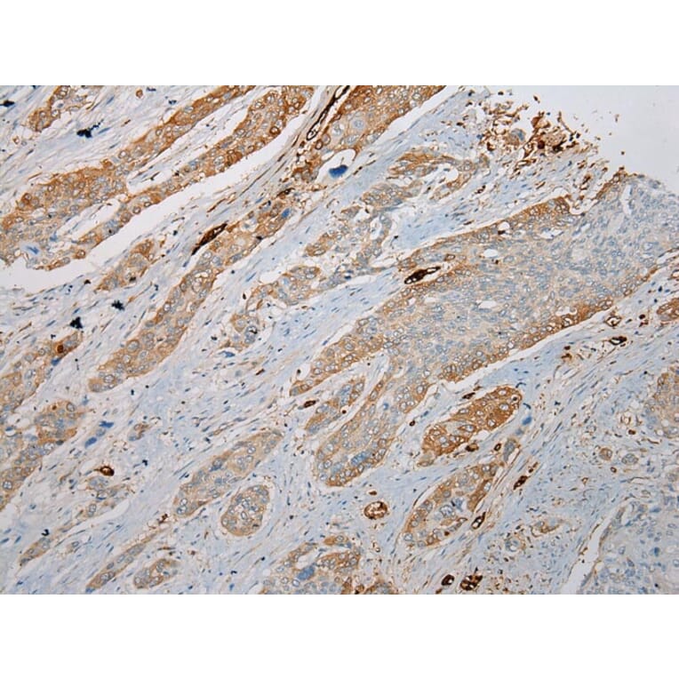 Immunohistochemistry - TREM1 Antibody from Signalway Antibody (43342) - Antibodies.com