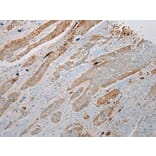 Immunohistochemistry - TREM1 Antibody from Signalway Antibody (43342) - Antibodies.com