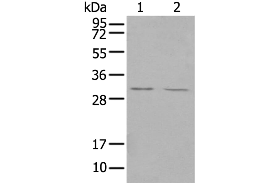TREM1 Antibody from Signalway Antibody (43342) - Antibodies.com