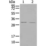 TREM1 Antibody from Signalway Antibody (43342) - Antibodies.com