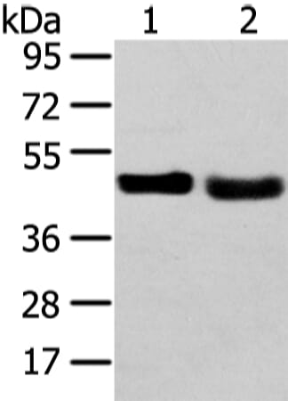 Gel: 8% SDS-PAGE Lysate: 40 &#956;g Lane 1-2: 231 cell and human fetal liver tissue Primary antibody: 1/450 dilution Secondary antibody: Goat anti rabbit IgG at 1/8000 dilution Exposure time: 1 minute