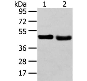 TRIB2 Antibody from Signalway Antibody (43343) - Antibodies.com