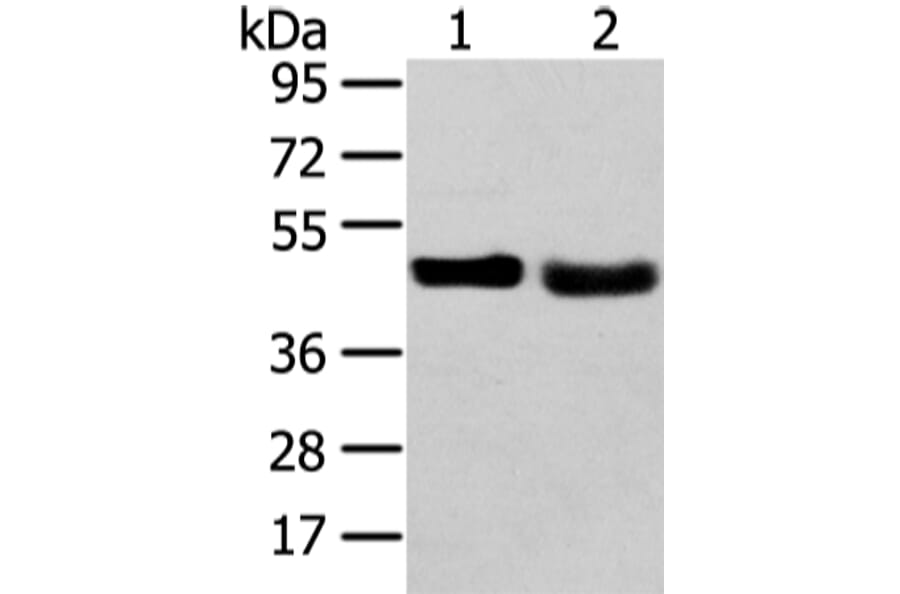 TRIB2 Antibody from Signalway Antibody (43343) - Antibodies.com