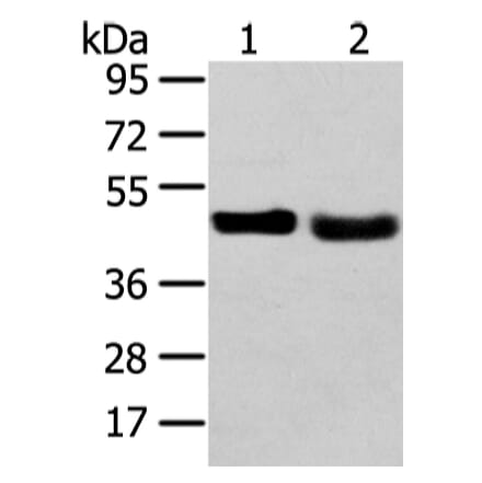 TRIB2 Antibody from Signalway Antibody (43343) - Antibodies.com