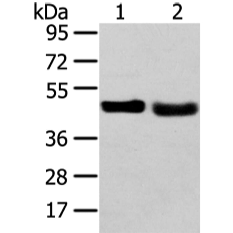 TRIB2 Antibody from Signalway Antibody (43343) - Antibodies.com
