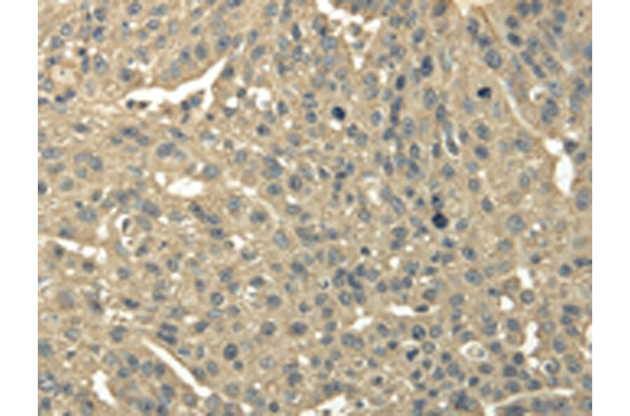 Immunohistochemistry - TRIB2 Antibody from Signalway Antibody (43343) - Antibodies.com