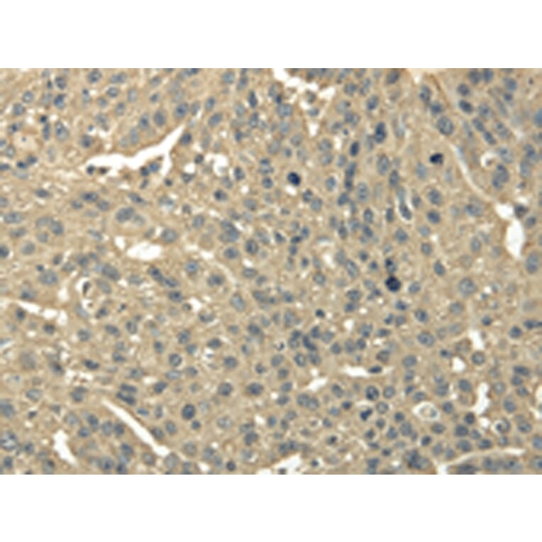 Immunohistochemistry - TRIB2 Antibody from Signalway Antibody (43343) - Antibodies.com