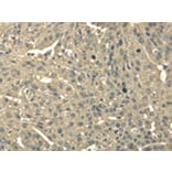 Immunohistochemistry - TRIB2 Antibody from Signalway Antibody (43343) - Antibodies.com