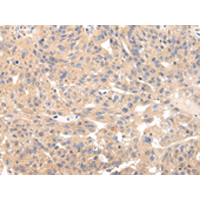 Immunohistochemistry - USP47 Antibody from Signalway Antibody (43345) - Antibodies.com