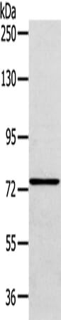 Gel: 6%SDS-PAGE Lysate: 40 &#956;g Lane: A172 cell Primary antibody: 1/200 dilution Secondary antibody: Goat anti rabbit IgG at 1/8000 dilution Exposure time: 30 seconds