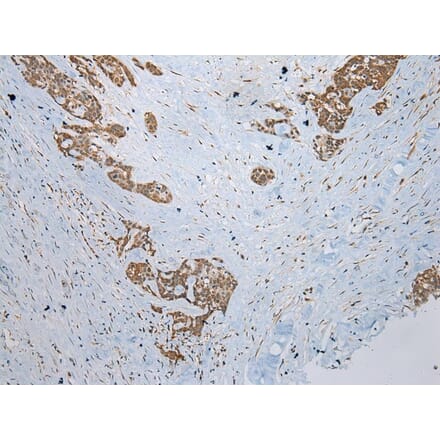 Immunohistochemistry - CCBL1 Antibody from Signalway Antibody (43357) - Antibodies.com