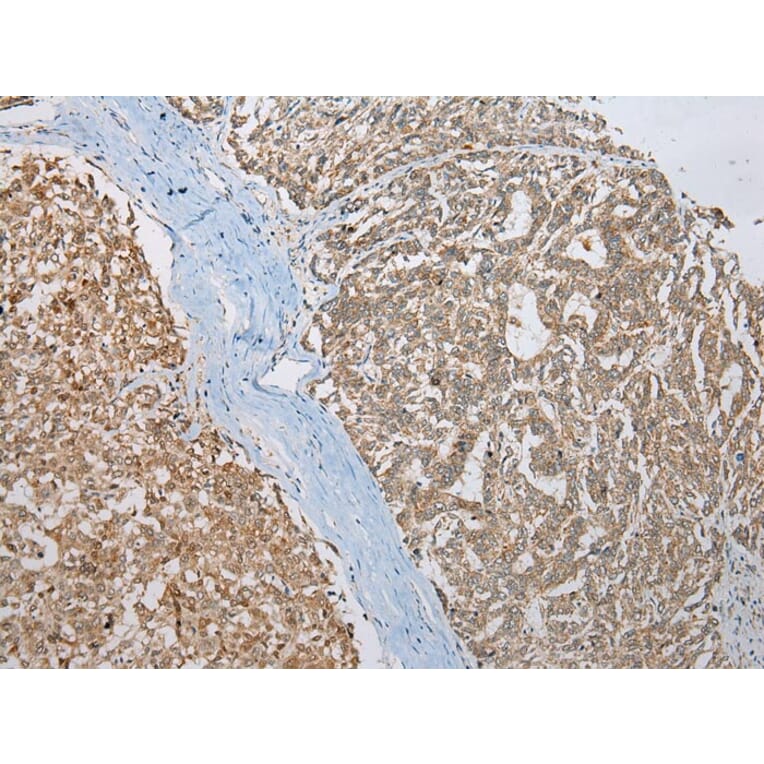 Immunohistochemistry - CCBL1 Antibody from Signalway Antibody (43357) - Antibodies.com