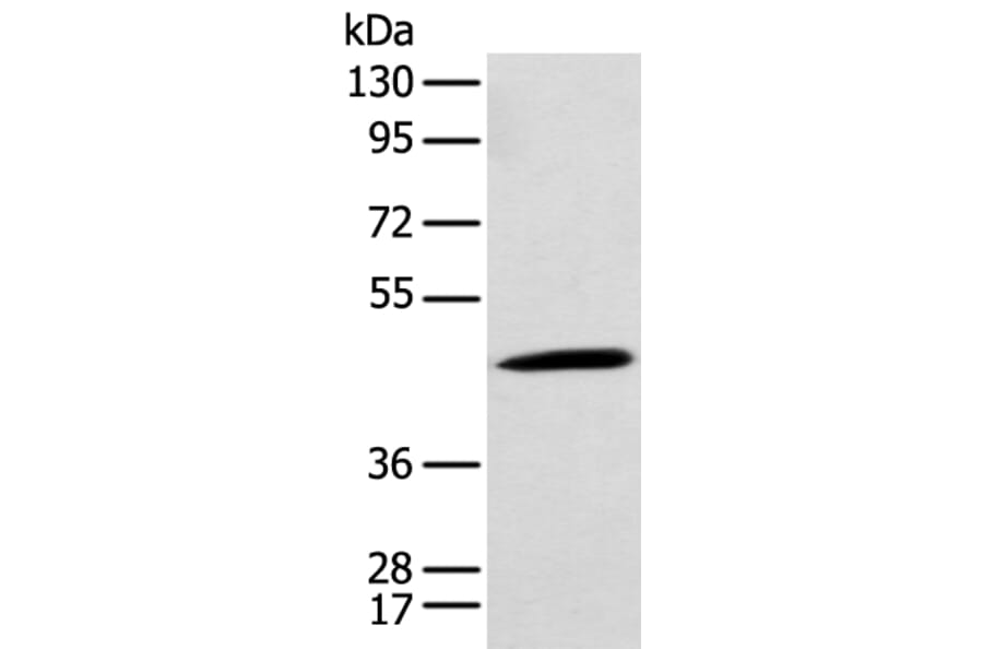 CCBL1 Antibody from Signalway Antibody (43357) - Antibodies.com