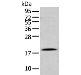 DAND5 Antibody from Signalway Antibody (43367) - Antibodies.com
