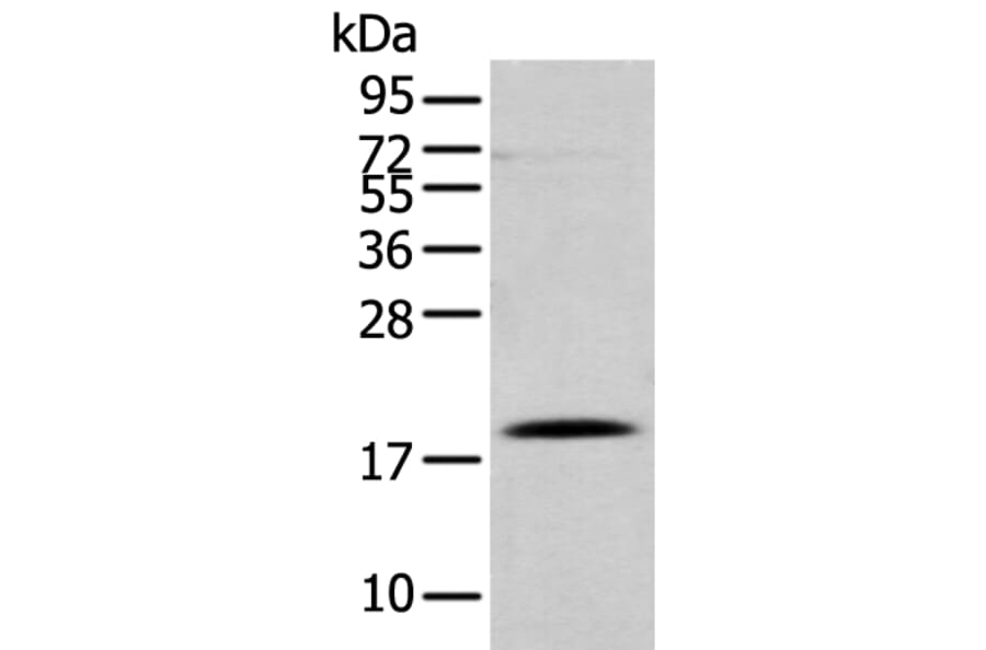 DAND5 Antibody from Signalway Antibody (43367) - Antibodies.com