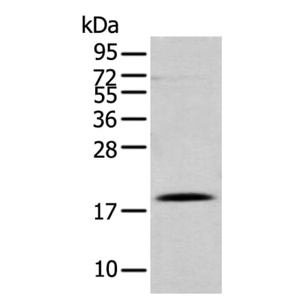 DAND5 Antibody from Signalway Antibody (43367) - Antibodies.com