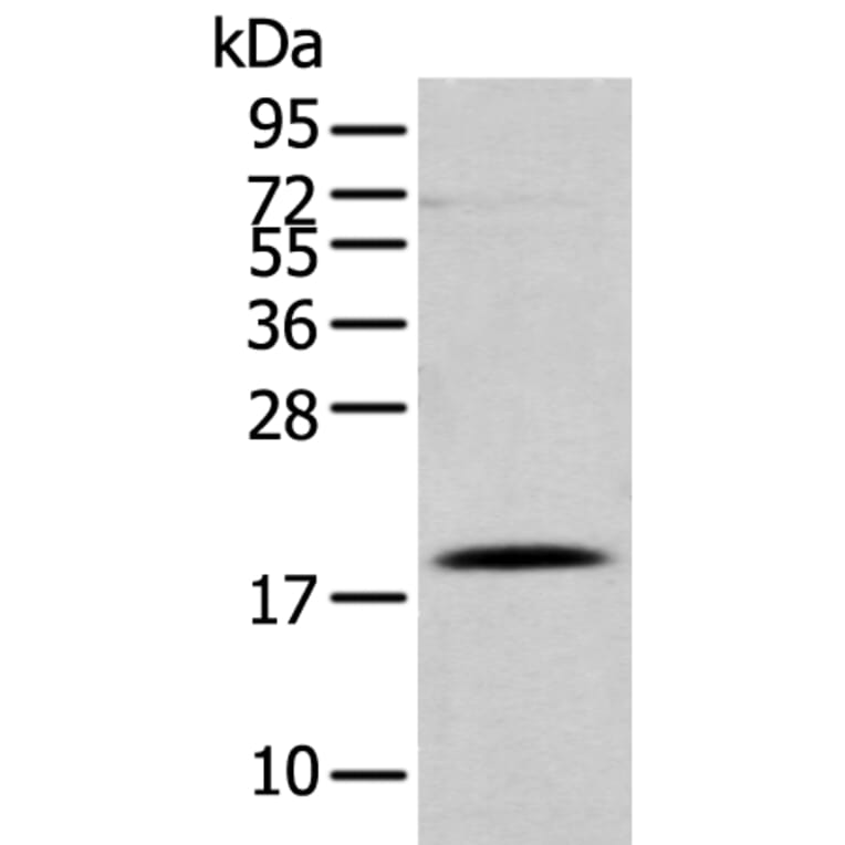 DAND5 Antibody from Signalway Antibody (43367) - Antibodies.com