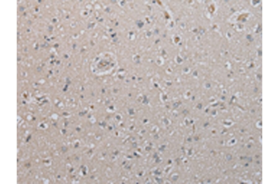 Immunohistochemistry - DAND5 Antibody from Signalway Antibody (43367) - Antibodies.com