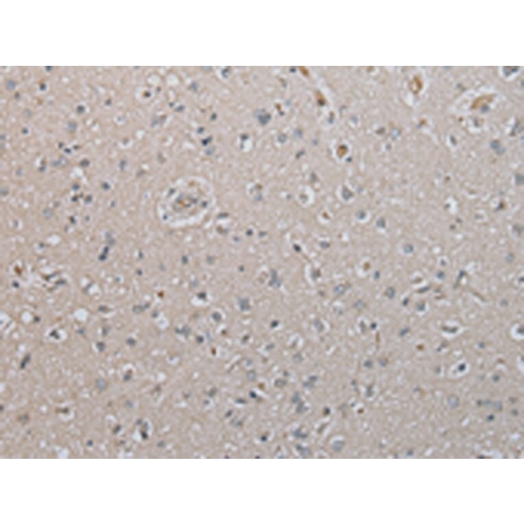 Immunohistochemistry - DAND5 Antibody from Signalway Antibody (43367) - Antibodies.com