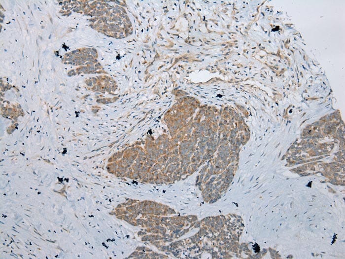 Immunohistochemical analysis of paraffin-embedded Human Thyroid tissue using #43368 at dilution 1/200,