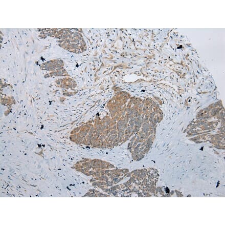 Immunohistochemistry - RSPH1 Antibody from Signalway Antibody (43368) - Antibodies.com