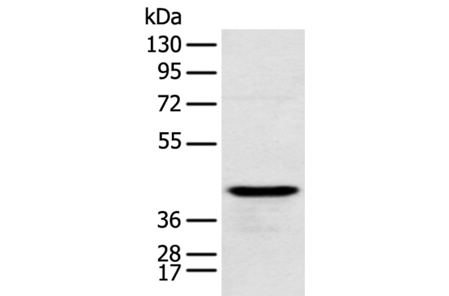 RSPH1 Antibody from Signalway Antibody (43368) - Antibodies.com