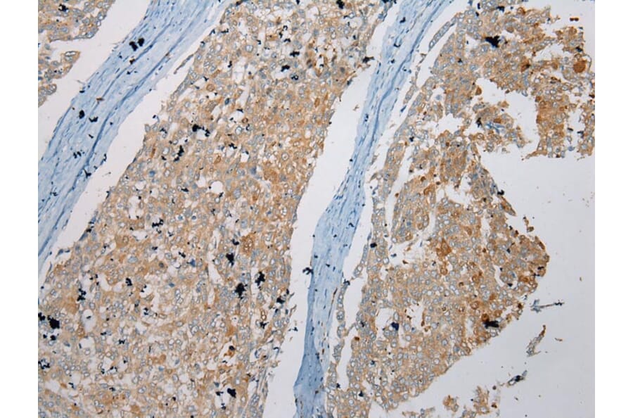 Immunohistochemistry - NUDT6 Antibody from Signalway Antibody (43373) - Antibodies.com