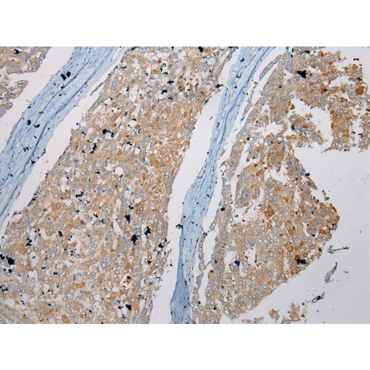 Immunohistochemistry - NUDT6 Antibody from Signalway Antibody (43373) - Antibodies.com