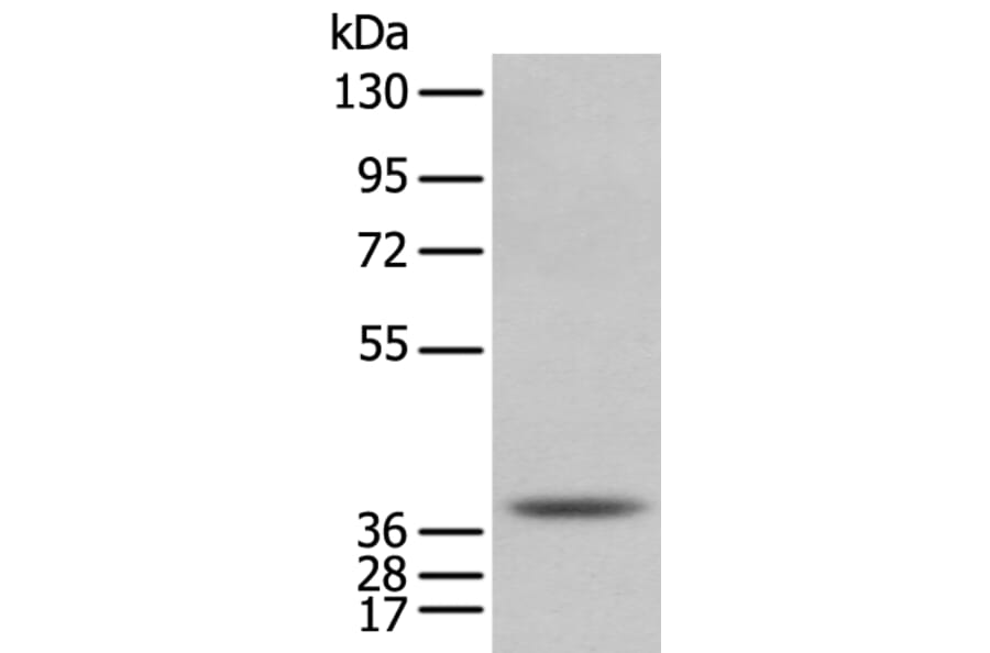 NUDT6 Antibody from Signalway Antibody (43373) - Antibodies.com