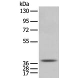 NUDT6 Antibody from Signalway Antibody (43373) - Antibodies.com