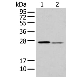 GSTM2 Antibody from Signalway Antibody (43377) - Antibodies.com