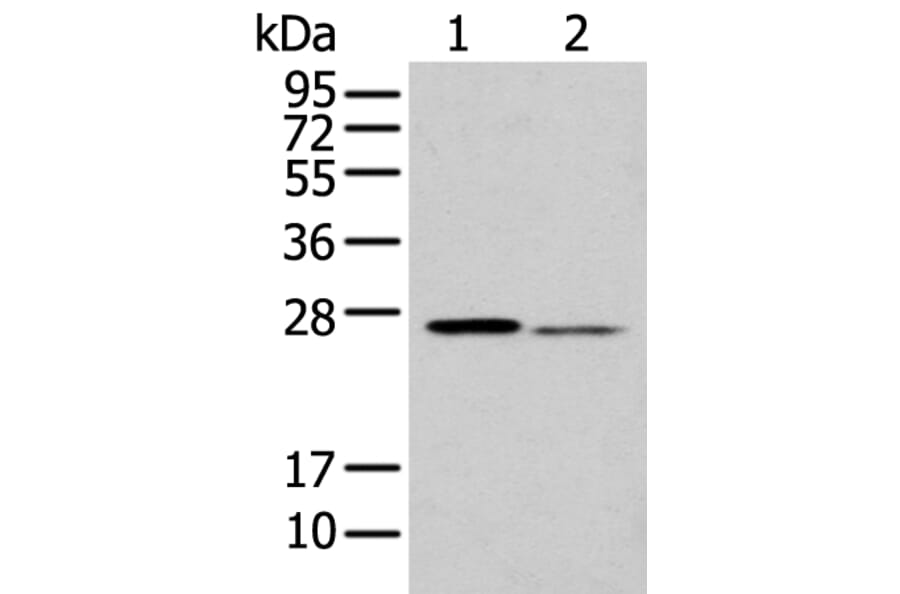 GSTM2 Antibody from Signalway Antibody (43377) - Antibodies.com