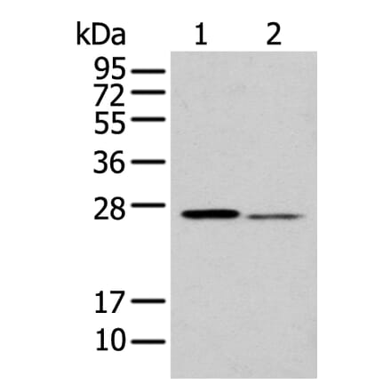 GSTM2 Antibody from Signalway Antibody (43377) - Antibodies.com